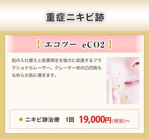 重症ニキビ跡【エコツー eCO2】ニキビ治療 1回 19,000円（税別）〜