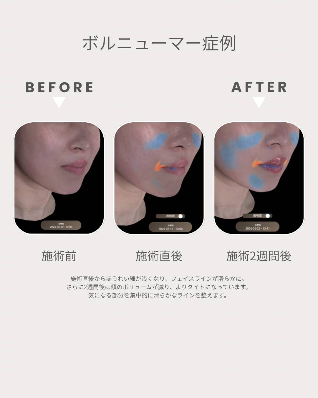 BEFORE AFTER