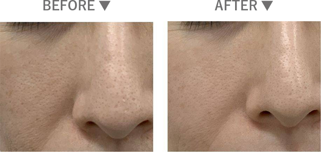 BEFORE AFTER
